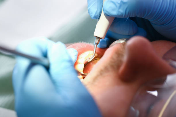 Best Emergency Treatment for Toothache in Neuse Forest, NC