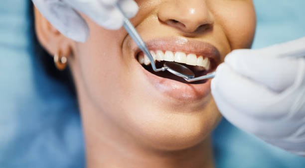 Best Emergency Wisdom Teeth Removal in Neuse Forest, NC