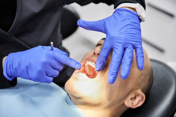 Best Emergency Tooth Extraction in Neuse Forest, NC