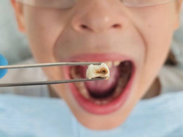 Best Same-Day Emergency Dentist in Neuse Forest, NC