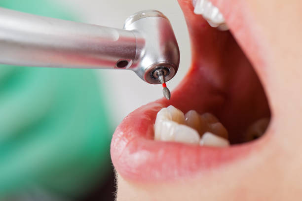 Best Emergency Tooth Extraction in Neuse Forest, NC